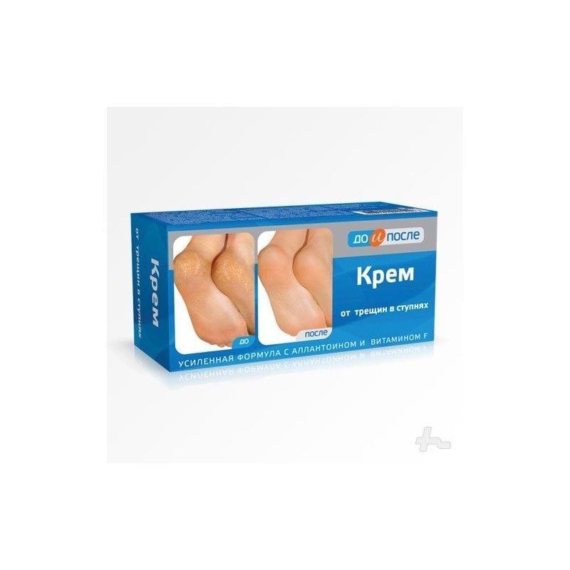 DO I POSLE JALAKREEM LÕHENENUD KANDADELE 150ML