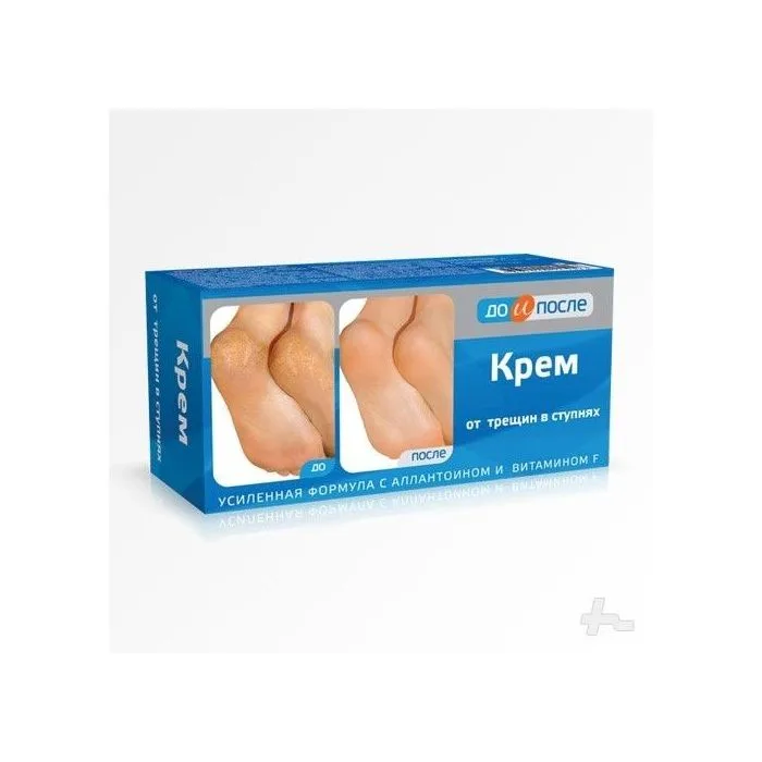 DO I POSLE JALAKREEM LÕHENENUD KANDADELE 150ML